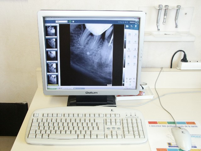 Installation radiologie numérique vue écran praticien